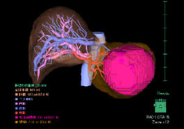 肝臓解析