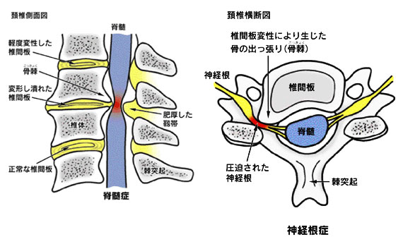 図３（日本整形外科学会のパンフレットより）