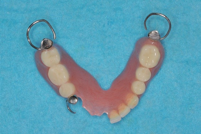 レジン床義歯２