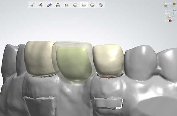 クラウンブリッジ補綴学講座の特徴