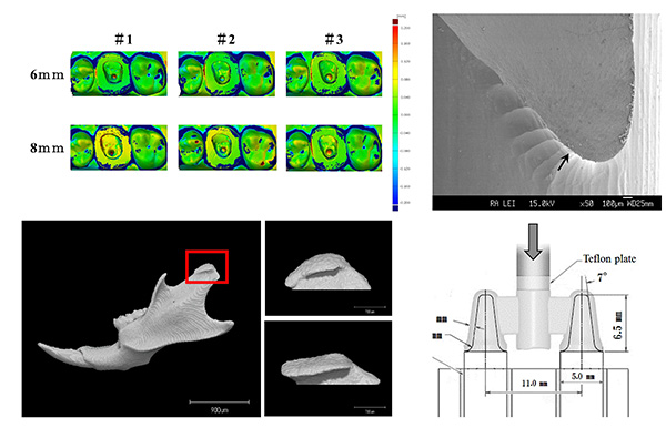 クラウンブリッジ補綴学講座の研究
