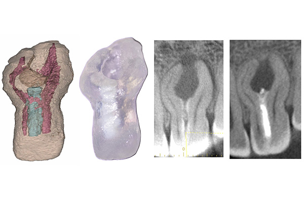 歯内療法学講座の研究