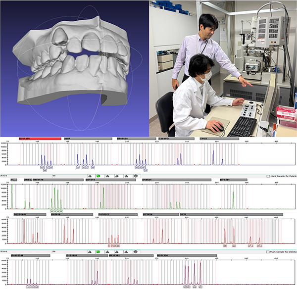 法歯学・法人類学講座の研究