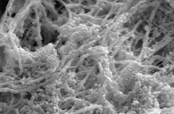 微生物学講座の研究