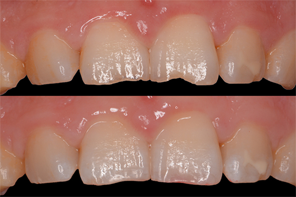 保存修復学講座の臨床