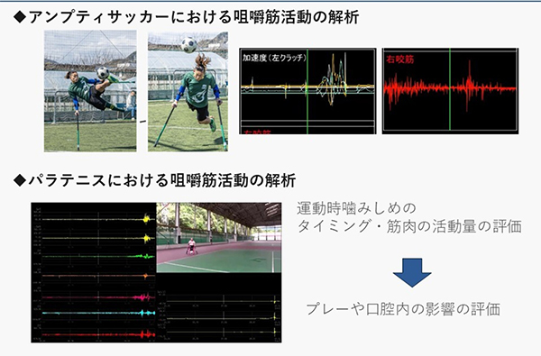 口腔健康科学講座 スポーツ歯学研究室の研究