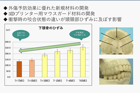 口腔健康科学講座 スポーツ歯学研究室の研究