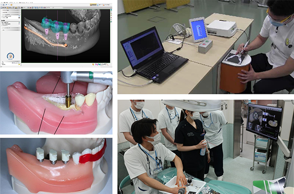 口腔インプラント学講座の教育