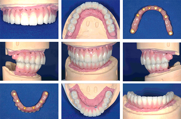 口腔インプラント学講座の臨床