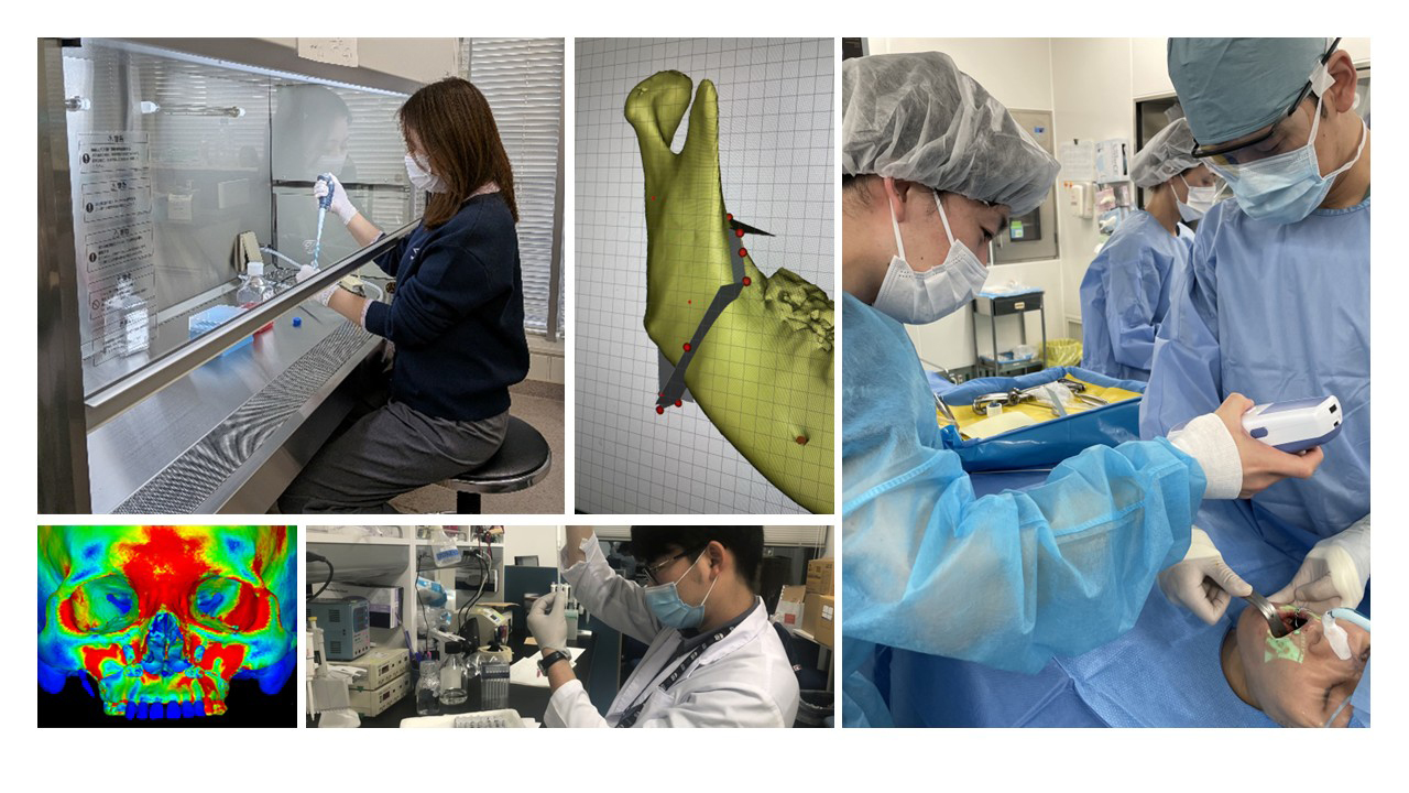 口腔顎顔面外科学講座の研究