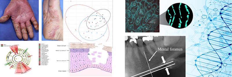 口腔腫瘍外科学講座の研究