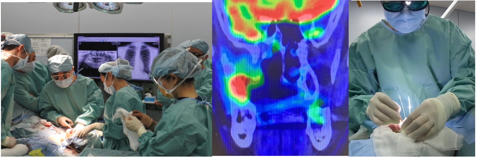 口腔腫瘍外科学講座の臨床