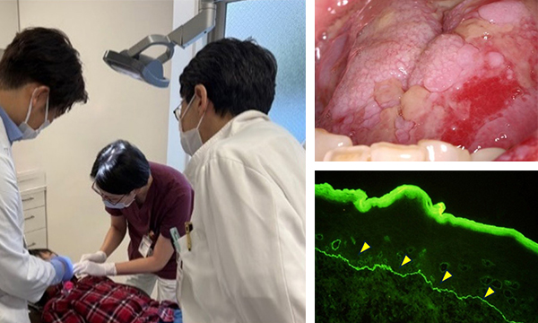 口腔腫瘍外科学講座の臨床