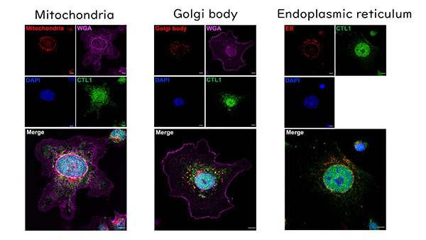 口腔病態外科学講座の研究