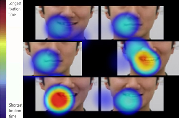 歯科矯正学講座の研究