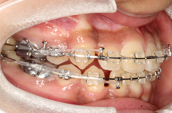 歯科矯正学講座の臨床