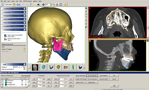 歯科矯正学講座の臨床