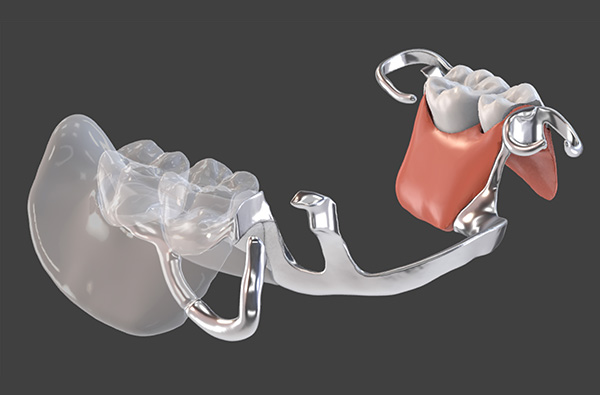 パーシャルデンチャー補綴学講座の教育