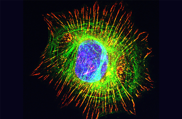 病理学講座の研究