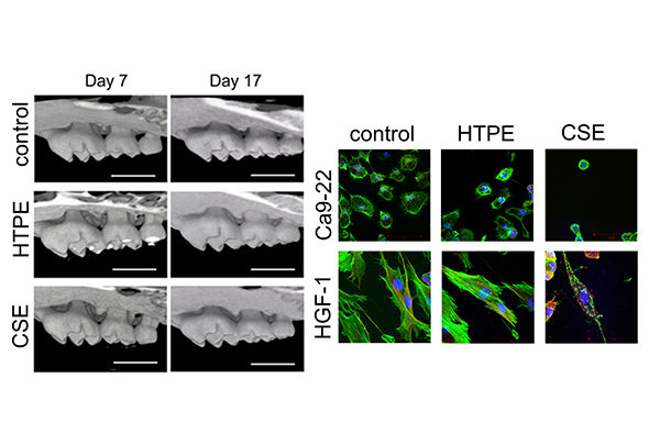 歯周病学講座の研究