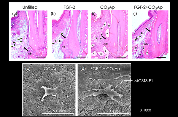歯周病学講座の研究