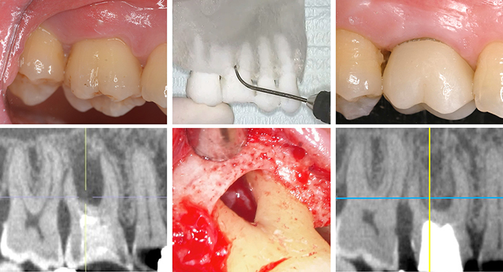 歯周病学講座の臨床