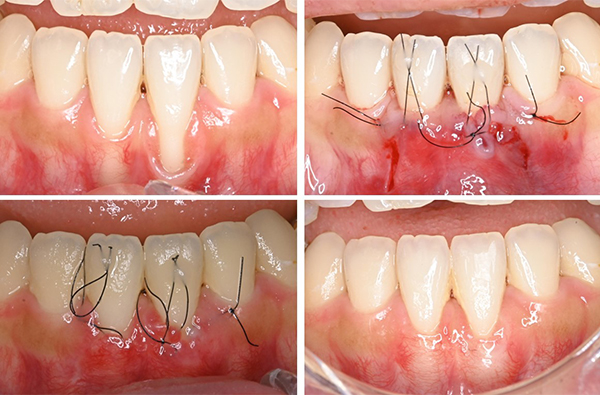 歯周病学講座の臨床
