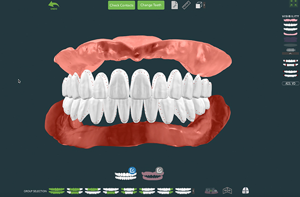 老年歯科補綴学講座の臨床