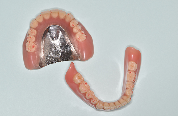 老年歯科補綴学講座の臨床