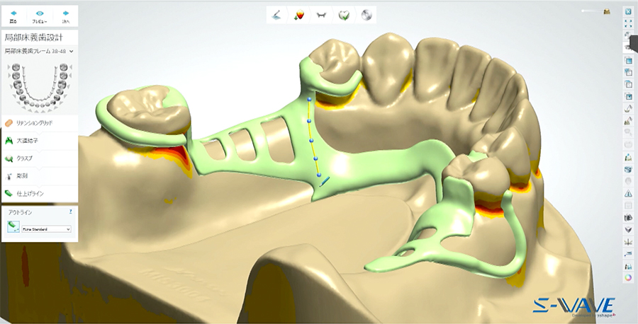 「デジタルデンティストリー」に対応した教育