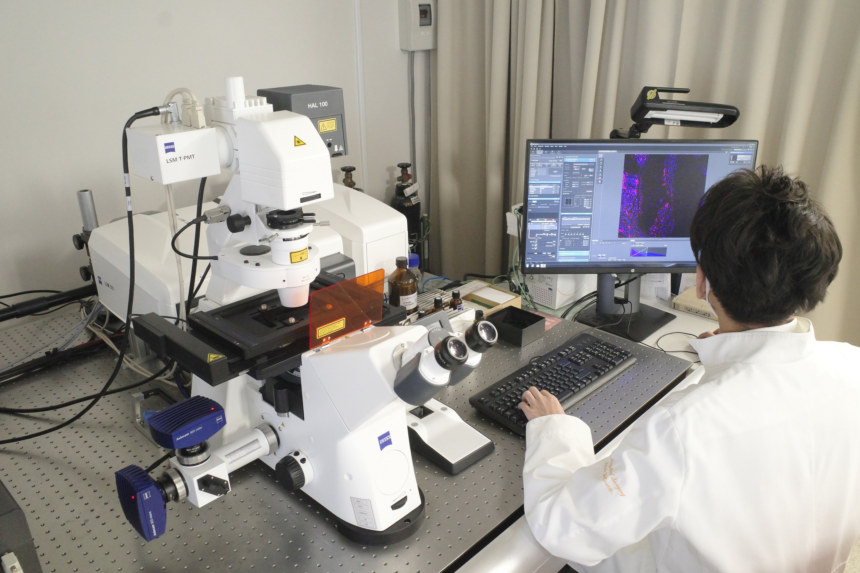 共焦点レーザースキャン顕微鏡