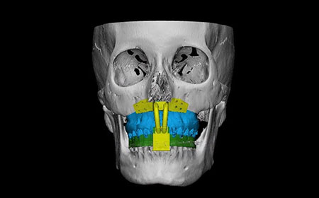 私立大学研究ブランディング事業（顎骨疾患プロジェクト）