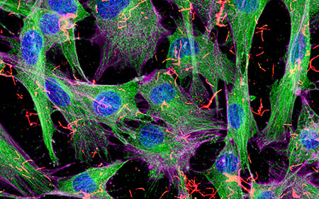 平成28年度顎骨疾患プロジェクト