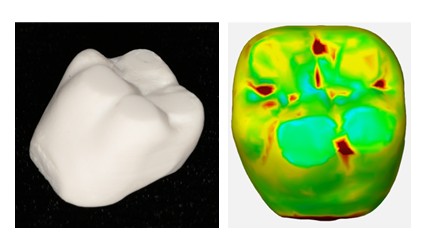 井内茉莉奈大学院生　令和7年度公益社団法人日本補綴歯科学会東京支部にて優秀研究発表賞受賞