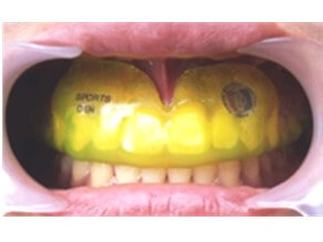 ラミネートタイプ01