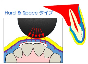 ハード＆スペースタイプ02