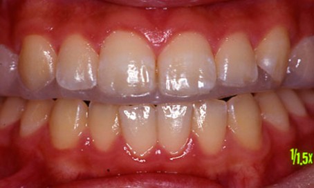 スポーツスプリント