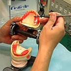 歯科技工とは? イメージ