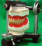 歯科技工士とは? イメージ